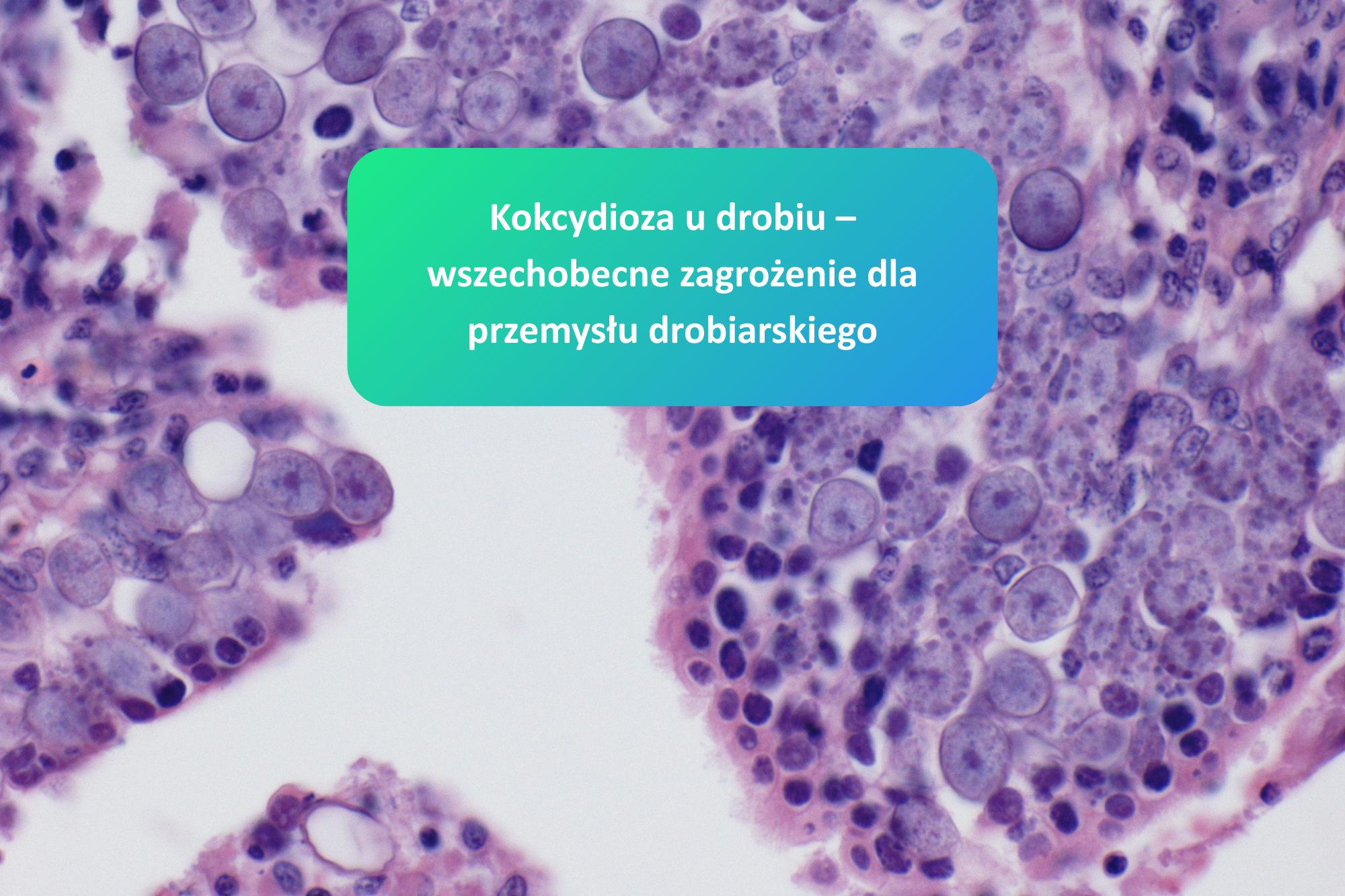 Kokcydioza